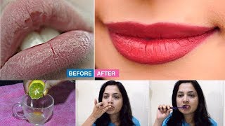 ಒಂದೇ ದಿನದಲ್ಲಿ ಪಿಂಕ್ ಲಿಪ್ಸ್ ಪಡೆಯಿರಿ  Get Baby Soft Pink Lips Naturally At Home In Just 1 Day [upl. by Milzie]