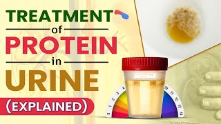 Treatment Of Protein In Urine Explained [upl. by Erdah]