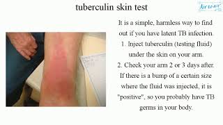 tuberculin skin test English  Medical terminology for medical students [upl. by Ahsan]