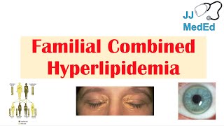 quotA Common Genetic Cause of High LDL Cholesterolquot Familial Combined Hyperlipidemia [upl. by Nolak]