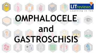 Omphalocele and Gastroschisis [upl. by Bertold675]