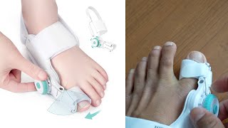 TENICORE Bunion Corrector Review [upl. by Buck668]