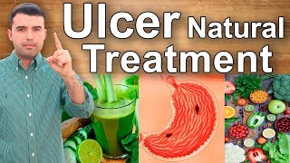 How to Cure Gastric Ulcers Caused by Gastritis  Home Remedies Juices and Supplements for Ulcers [upl. by Gazo480]