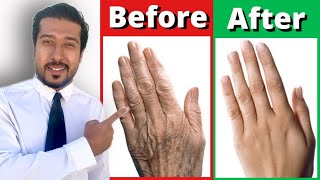 2 Fast Remedies for Dry and Wrinkled Hands THAT WORK [upl. by Hbahsur]