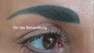 Permanent Makeup Entfernung der Augenbrauen [upl. by Erdreid94]