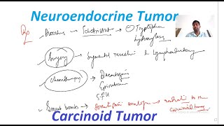 Carcinoid Tumor  Neuroendocrine Tumor  General Surgery Lectures  MBBS MS DNB MRCS  MCh Urology [upl. by Ikcin]