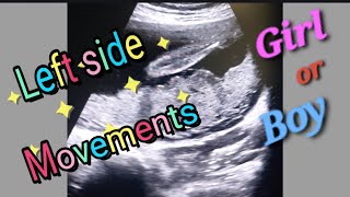 Posterior Placenta With Fetal Heartbeat 130bpm  Left side Baby Movement  27Weeks Baby Genderreveal [upl. by Okihsoy883]