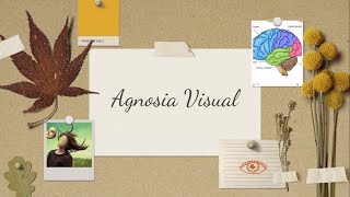 Agnosia Visual [upl. by Enos428]