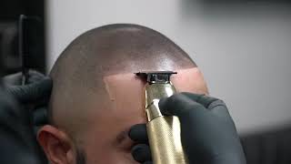 Scalp Micropigmentation in Scottsdale [upl. by Ahseka714]