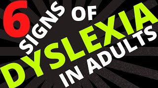 6 Signs of Dyslexia in ADULTS [upl. by Butterfield33]