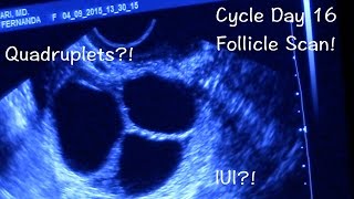 TTC Update CD16 Follicle Scan [upl. by Niki33]