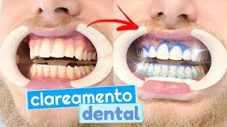 Tudo sobre meu clareamento dental dúvidas e como funciona clarear os dentes 😬💉 [upl. by Odnaloy516]