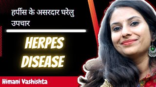 हर्पीस के असरदार घरेलु उपचार ।। Home remedies for herpes disease in Hindi 2022 [upl. by Adnilreh582]