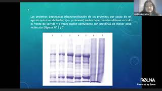 Electroforesis de proteínas  Iniciación científica 19 [upl. by Ahsened]