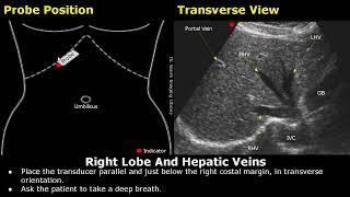 Liver Ultrasound Probe Positioning  Transducer Placement For Liver Scanning  Abdominal USG [upl. by Goldfarb675]