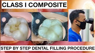 Step by Step Dental Filling Procedure  General Dentist Griya RR [upl. by Halona]