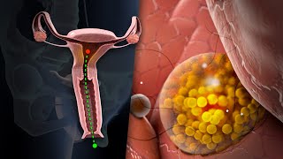 Ovulation amp the Menstrual Cycle [upl. by Wilde]