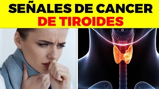 ASI EMPIEZA el Cáncer de Tiroides y nadie te lo dice signos y síntomas de cáncer de tiroides [upl. by Quent61]