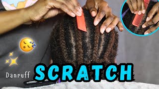 ASMR Scalp Scratching  Sleep and Relaxation  Real person  No talking 😴💤asmr [upl. by Ayotahs]