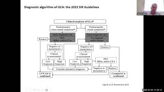 GIS4Plus  Le vasculiti in Medicina Interna quando sospettarle e come gestirle [upl. by Akinirt370]