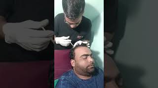 PRP for hair growth clinic tehseeniclinic prp prptreatment prpforhairloss [upl. by Dahsraf795]