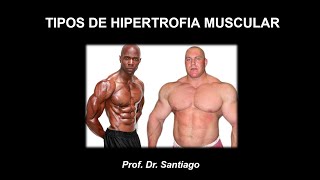 Aula 111  Tipos de Hipertrofia Muscular [upl. by Bithia940]