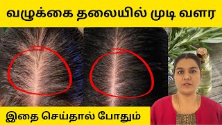 வழுக்கை தலையில் முடி வளர இதை செய்தால் போதும்  100 Effective  Baldness Remedy [upl. by Cathy]