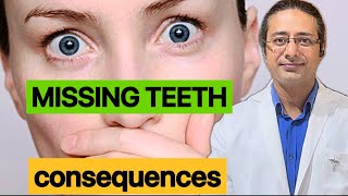 How to identify missing teeth problemsDisadvantages of missing teeth [upl. by Rambort]