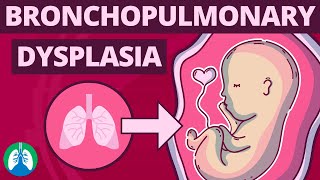 Bronchopulmonary Dysplasia BPD  Medical Definition and Explainer Video [upl. by Boj]