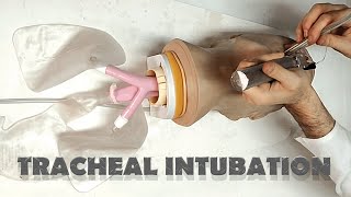 Tracheal tube placement  INTUBATION [upl. by Alius218]