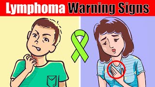 7 Warning Signs of Lymphoma You Shouldnt Ignore [upl. by Eba]