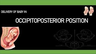 Fetal parameters  lie  presentation  presenting part  attitude  denominator  position [upl. by Nelubez]