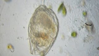 Rotifer  Lecane hamata [upl. by Dickerson902]