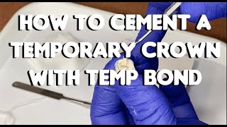 Cement a Temporary Crown w Temp Bond Temporary Cement [upl. by Eirrahs]