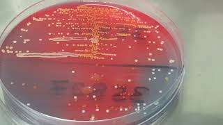 Staphylococcus saprophyticus colony morphology on CLED agar [upl. by Kareem38]