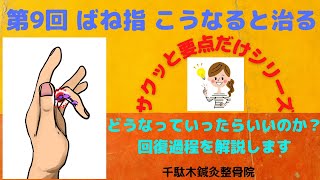 第９回 ひどいばね指 こうなってくると治ります 改善までの3つのステップ [upl. by Uthrop129]