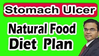 Stomach 🥑Gastric Ulcer 15 Natural Diet Plan Tips வயிறு அல்சர் புண் உடனே குணமடைய சரியாக 15 உணவு [upl. by Nahtaneoj849]