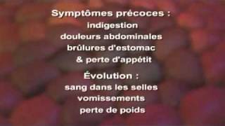 Cancer de l estomac Symptômes Définition Diagnostic Traitements [upl. by Akinoj]