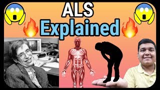 ALS  Amyotrophic Lateral Sclerosis explained  ALS cure [upl. by Niarb]