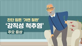 힐팁TV 진단 힘든 ‘가면 질환’‘강직성 척추염’ 주요 증상 [upl. by Leerzej908]