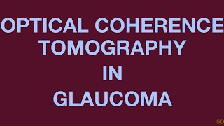 Glaucoma Session 10 Posterior Segment Imaging [upl. by Ligetti]