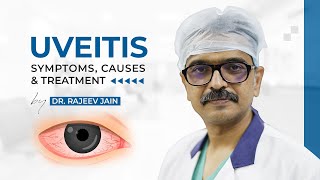 Uveitis  Causes Signs Symptoms Diagnosis amp Treatment  Dr Rajeev Jain  Delhi Best Eye Hospital [upl. by Perrine]