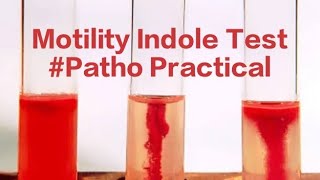 Motility Indole Patho Bacterial Motility Indole test [upl. by Ehtnax]