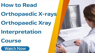 How to Read Orthopaedic Xrays  Orthopaedic Xray Interpretation Course [upl. by Jacinthe]