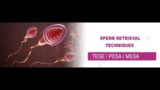 TESE SPERM PREPARATION ampicsi READY TO INJECTicsi maleinfertility azoospermia [upl. by Hermosa]