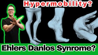 Ehlers Danlos Syndrome Hypermobility Symptoms Diagnosis amp Test [upl. by Okechuku]