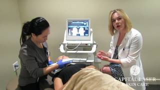 Ultherapy® NonSurgical Skin Tightening Treatment at Capital Laser amp Skin Care [upl. by Barnaba]