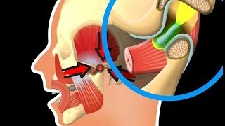 Besonderheiten des Kiefergelenks [upl. by Domel]