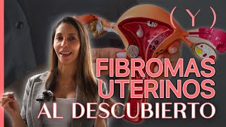 FIBROMAS UTERINOS AL DESCUBIERTO  Doctora Catalina Agudelo [upl. by Kudva]