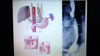 Esophagus  innervation and clinical correlates [upl. by Fari]